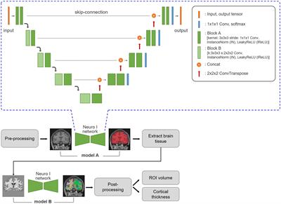 Development and validation of deep learning-based automatic brain segmentation for East Asians: A comparison with Freesurfer